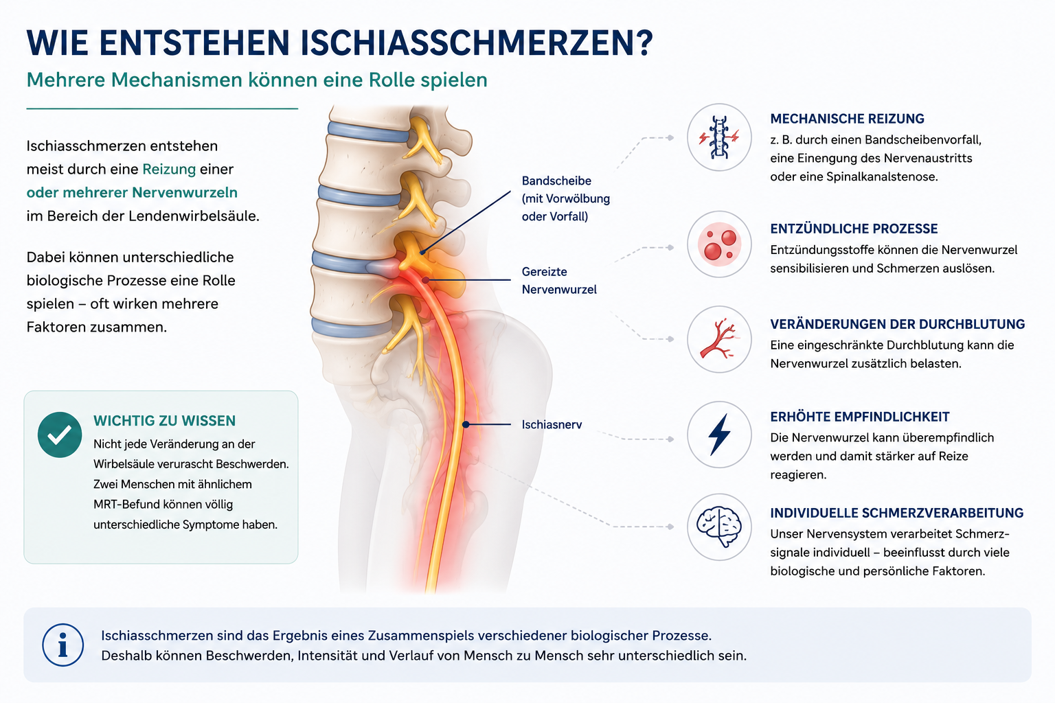 Infografik: Entstehung von Ischias – Reizung einer Nervenwurzel durch mechanische, entzündliche und sensibilisierende Faktoren.
