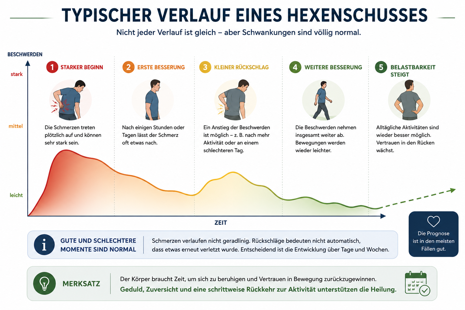 Infografik: Typischer Verlauf eines Hexenschusses mit guten und schlechteren Phasen.