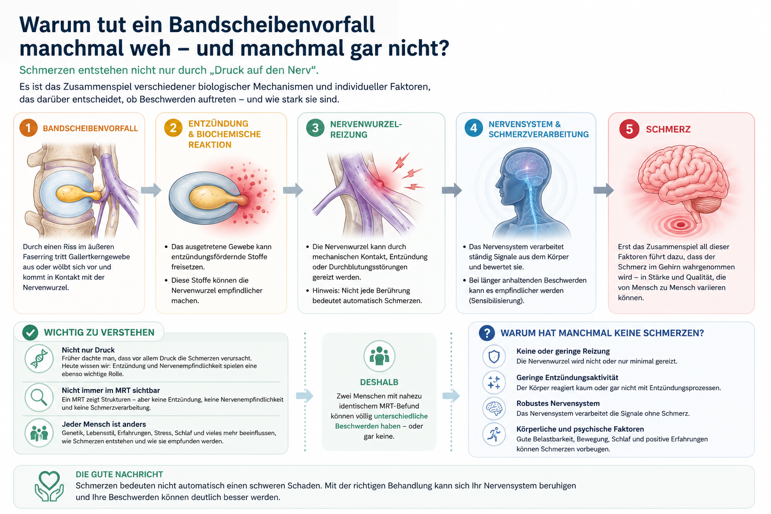 Infografik: Warum tut ein Bandscheibenvorfall manchmal weh? Zusammenspiel aus mechanischer Reizung, Entzündung und Schmerzverarbeitung.
